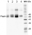 PsaA | PSI-A core protein of photosystem I